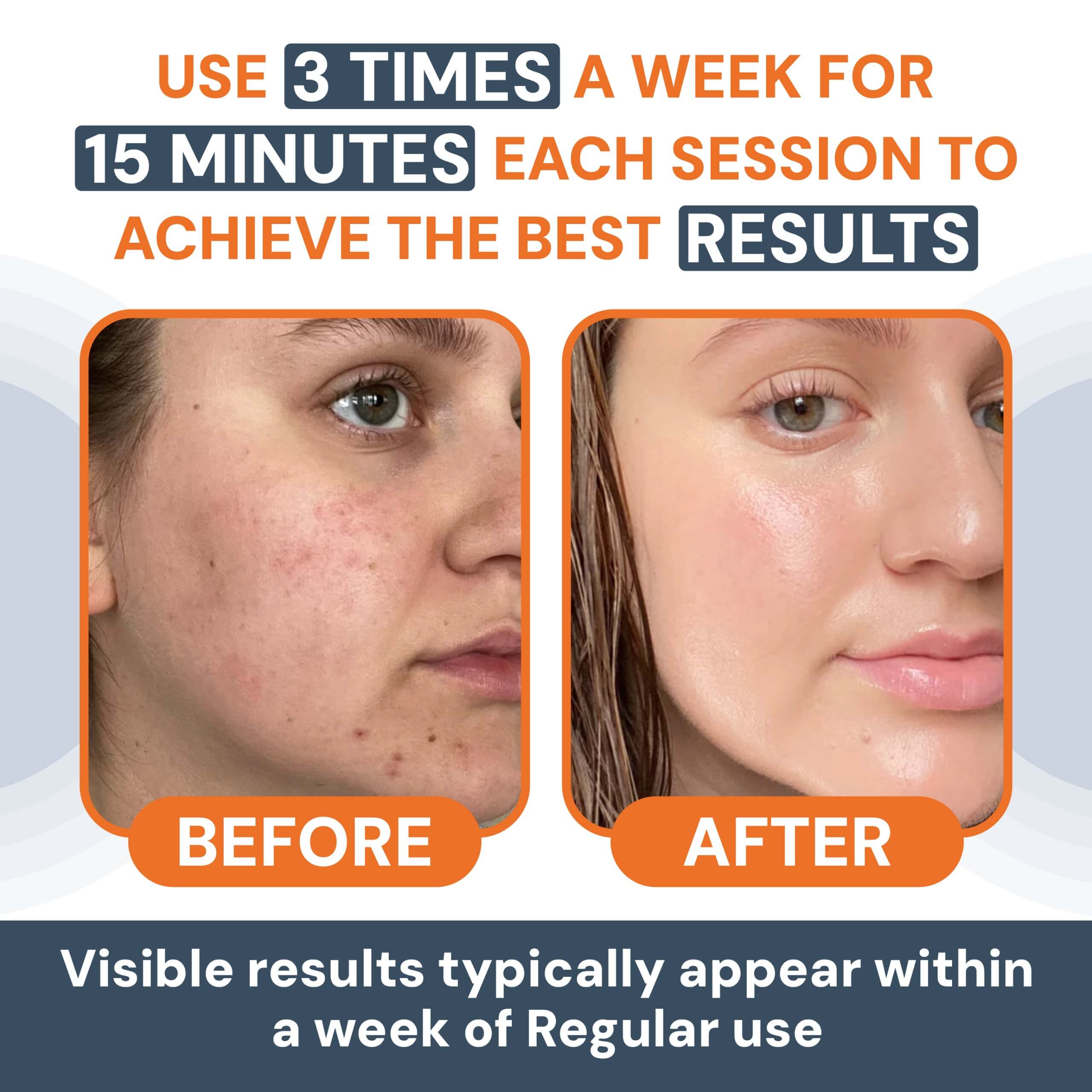 Face & Neck Lifting Massager | Face Sculptor