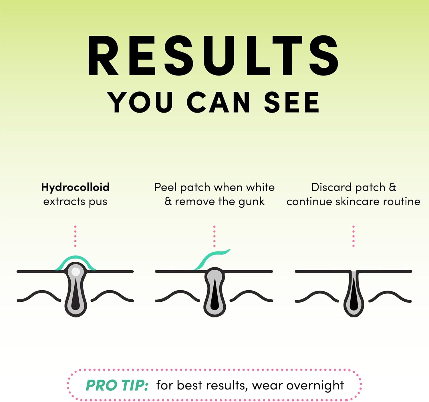 Acne | Spot | Pimple Patch