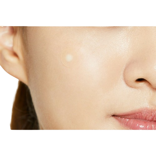 Acne | Spot | Pimple Patch