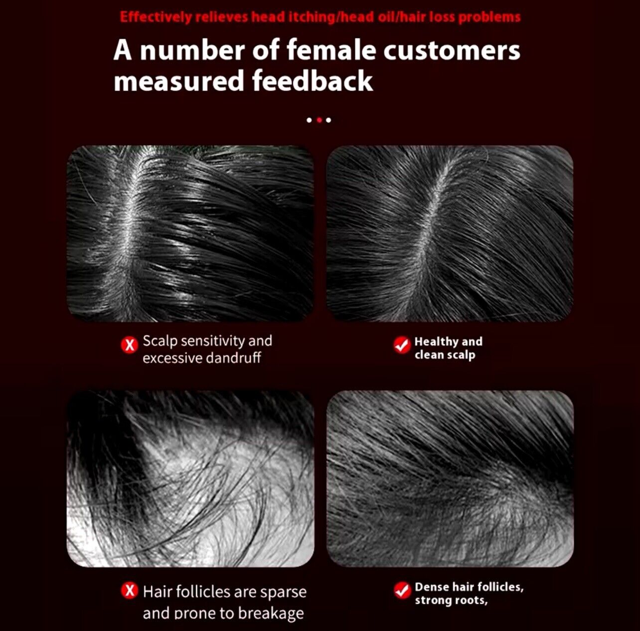 3-in-1 Scalp Massager for Hair Growth & Relaxation