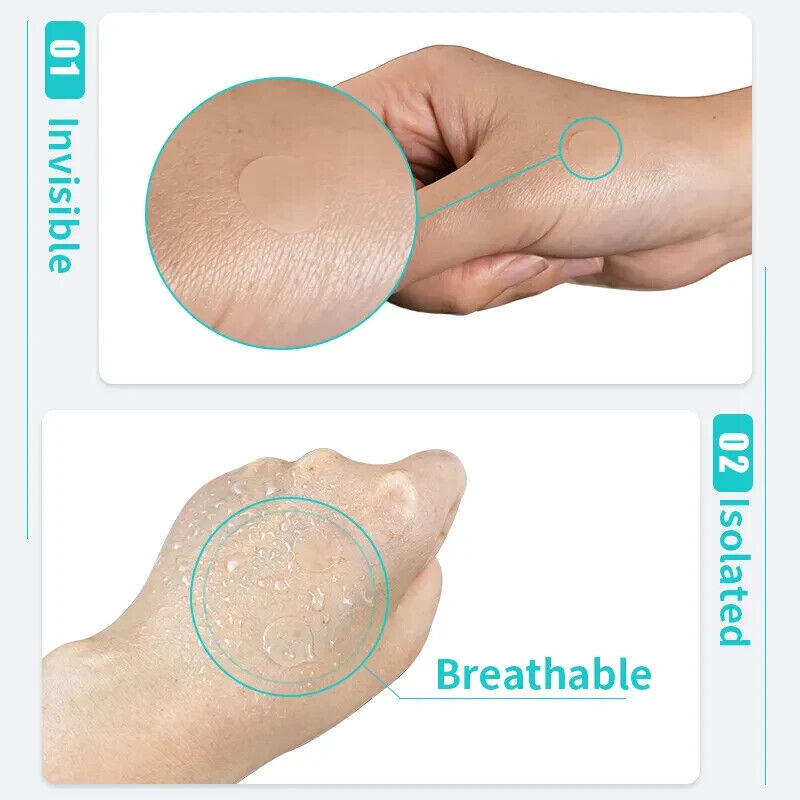 Acne | Spot | Pimple Patch